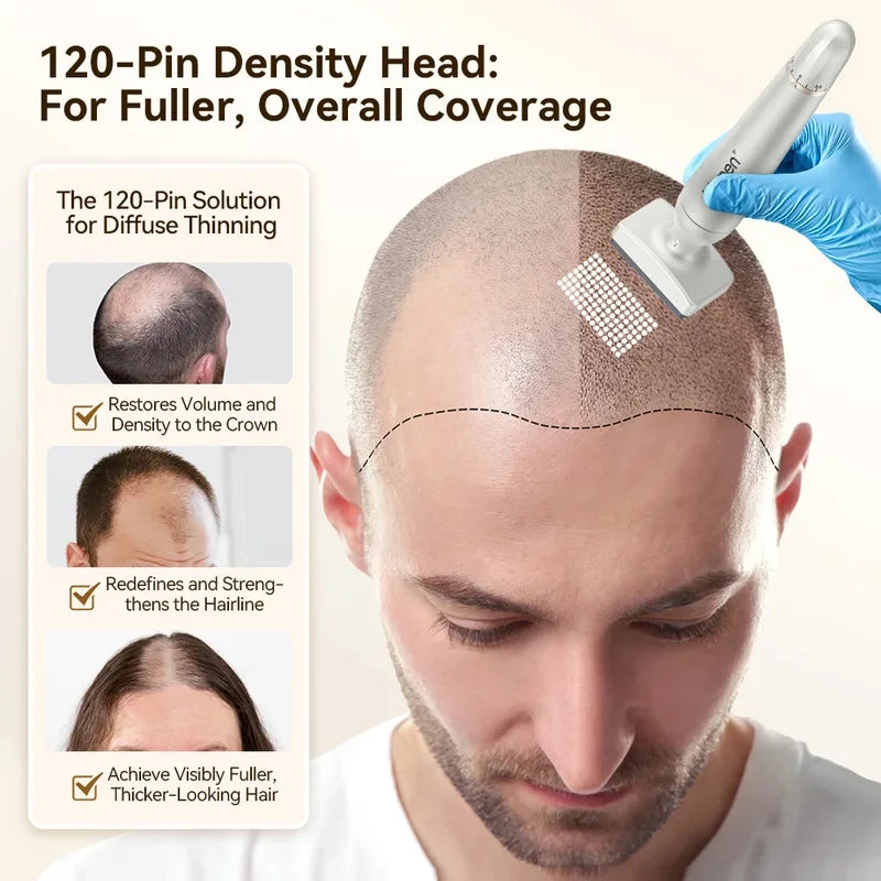 Silver adjustable 120-pin derma stamp microneedling pen for hair growth and scalp thinning, shown on a man's head.