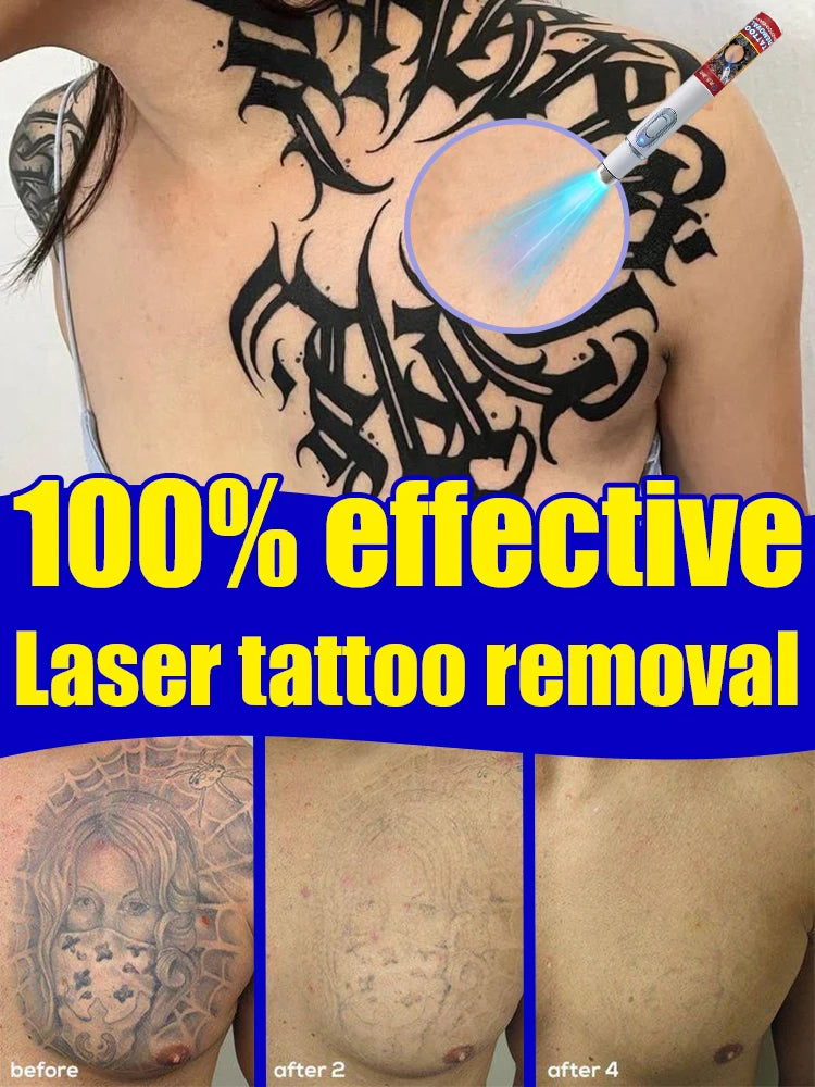 Nano Laser Tattoo Removal Machine - Professional PMU Device Permanent Makeup Machines Tidesmit