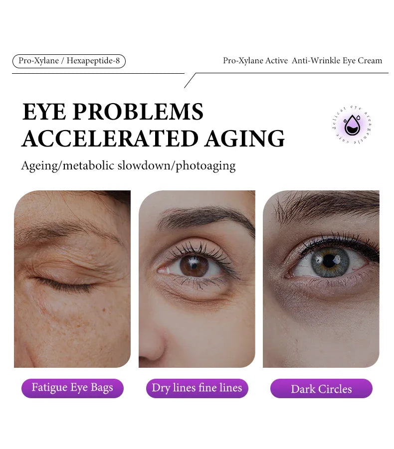 Anti-wrinkle eye cream showing before-and-after results for eye bags, fine lines, and dark circles.