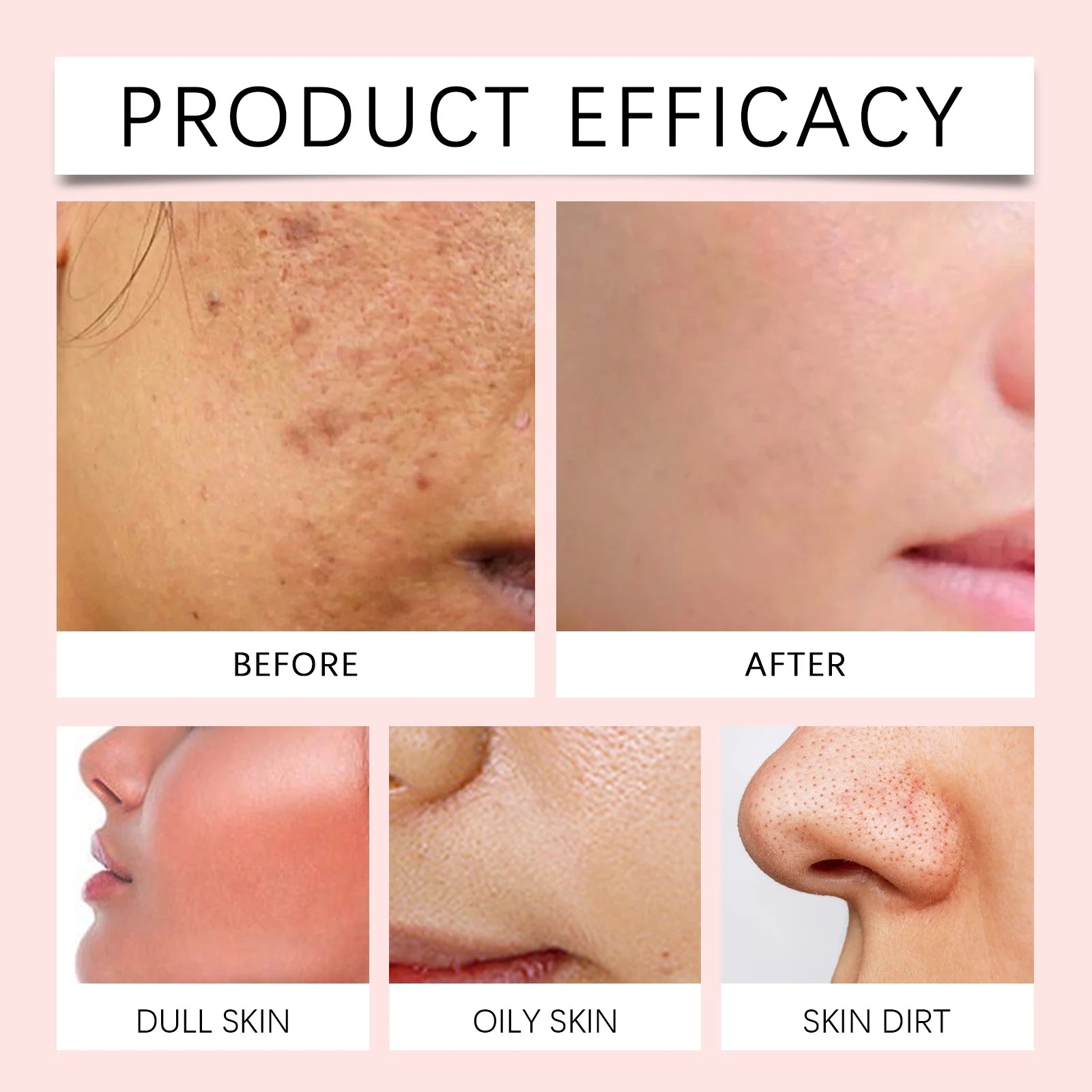 Succinic Acid Peeling Pads - Gentle Exfoliating Facial Treatment Scrubs Treatments Tidesmit