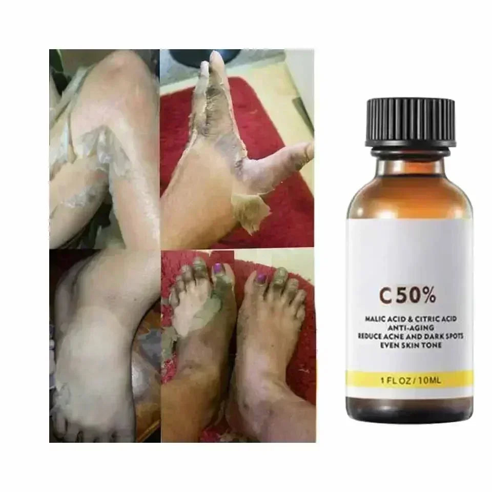 Salicylic Acid Face Peel - Professional Deep Exfoliation & Skin Refinement Scrubs Treatments Tidesmit