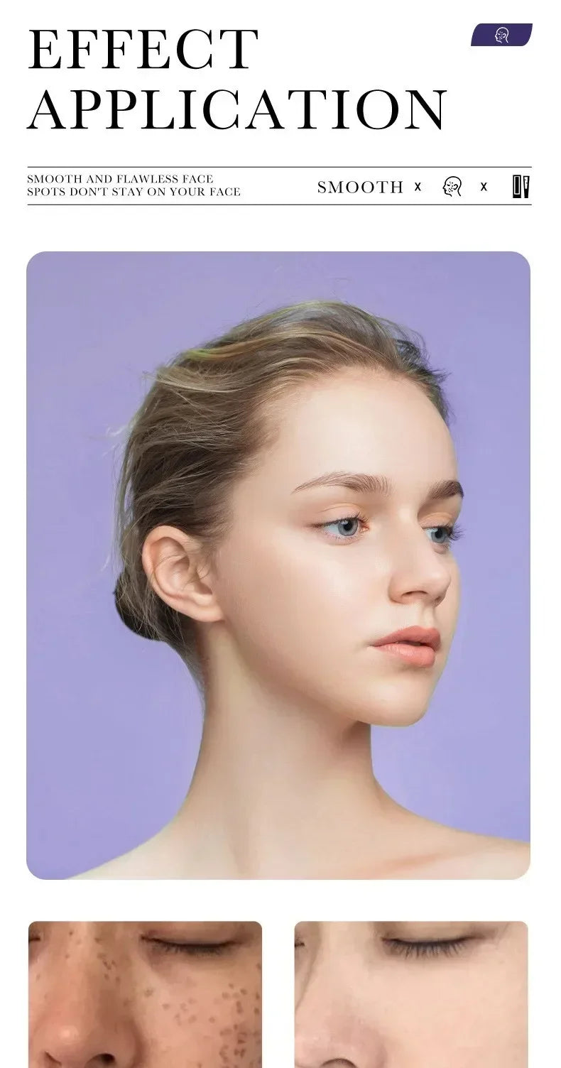 Tidesmit Mild Niacinamide Melasma Cream texture close-up for fading dark spots and moisturizing face makeup