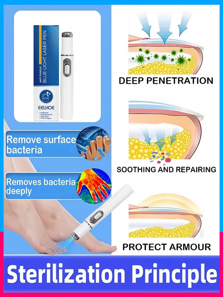 Nail Laser Pen for Onychomycosis - Portable Home Wellness Device Relaxation Treatment Tidesmit
