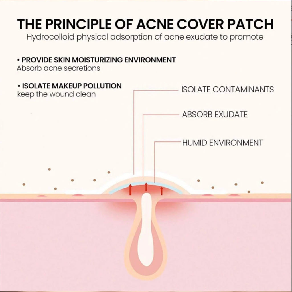 Tidesmit ultra-thin invisible acne patches for effective facial flaw coverage and spot treatment.