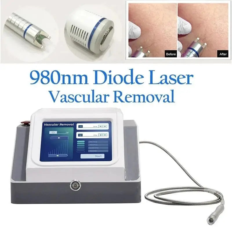 980nm diode laser spider vein removal machine with touchscreen interface, handpiece, and before-after treatment results.
