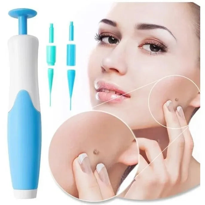 2-in-1 painless skin tag and mole removal device kit with blue and white applicator for home face and body treatment.