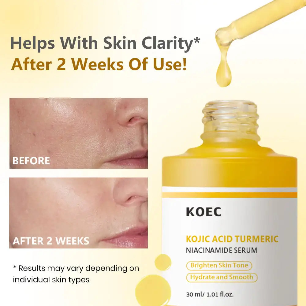 30ml KOEC Kojic Acid Turmeric Niacinamide Serum Hydrating Smoothing Brightening Improve Skin Clarity Anti-Aging Natural Formula