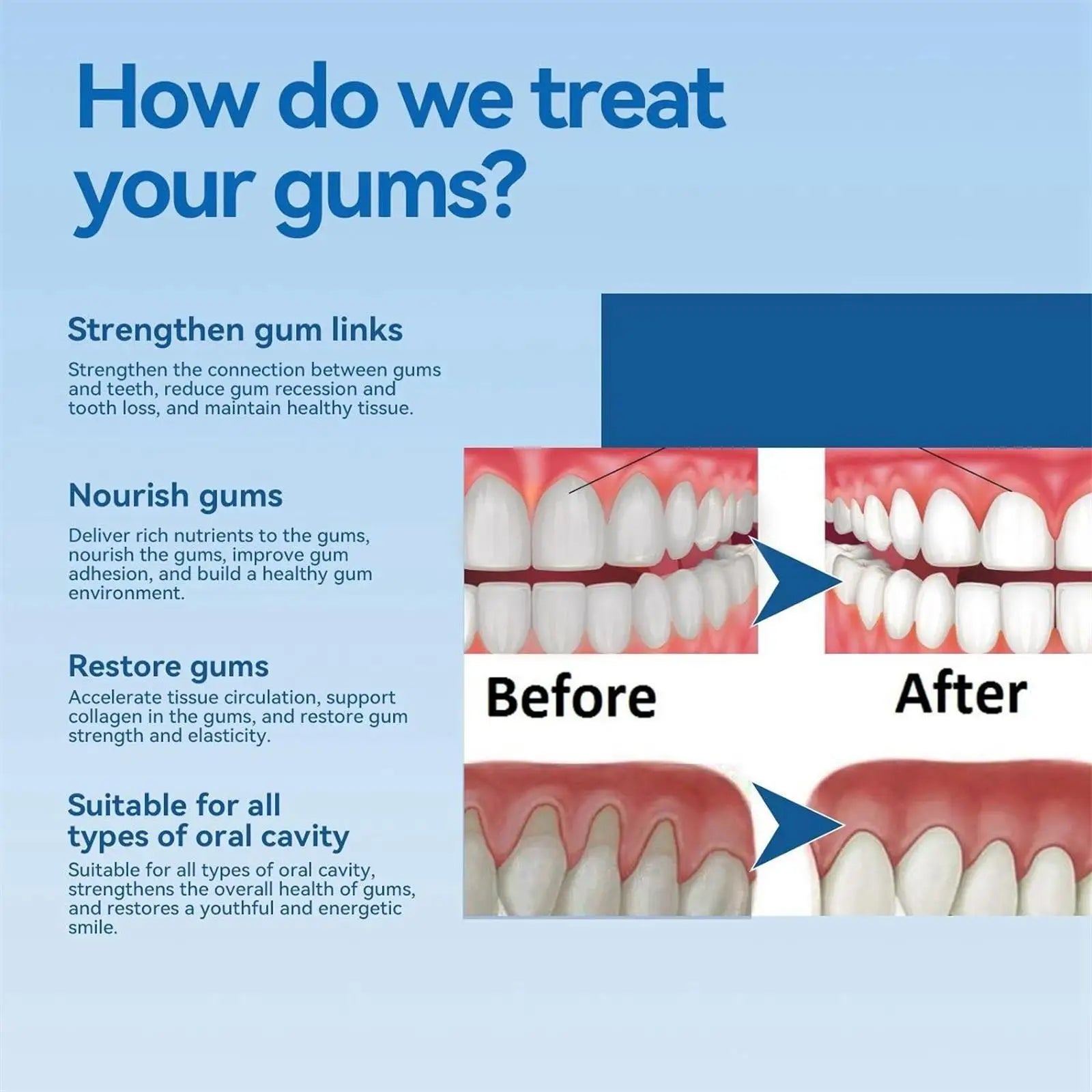 Tidesmit 50ml damage repair gum serum and teeth whitening toothpaste for sensitive teeth and oral care