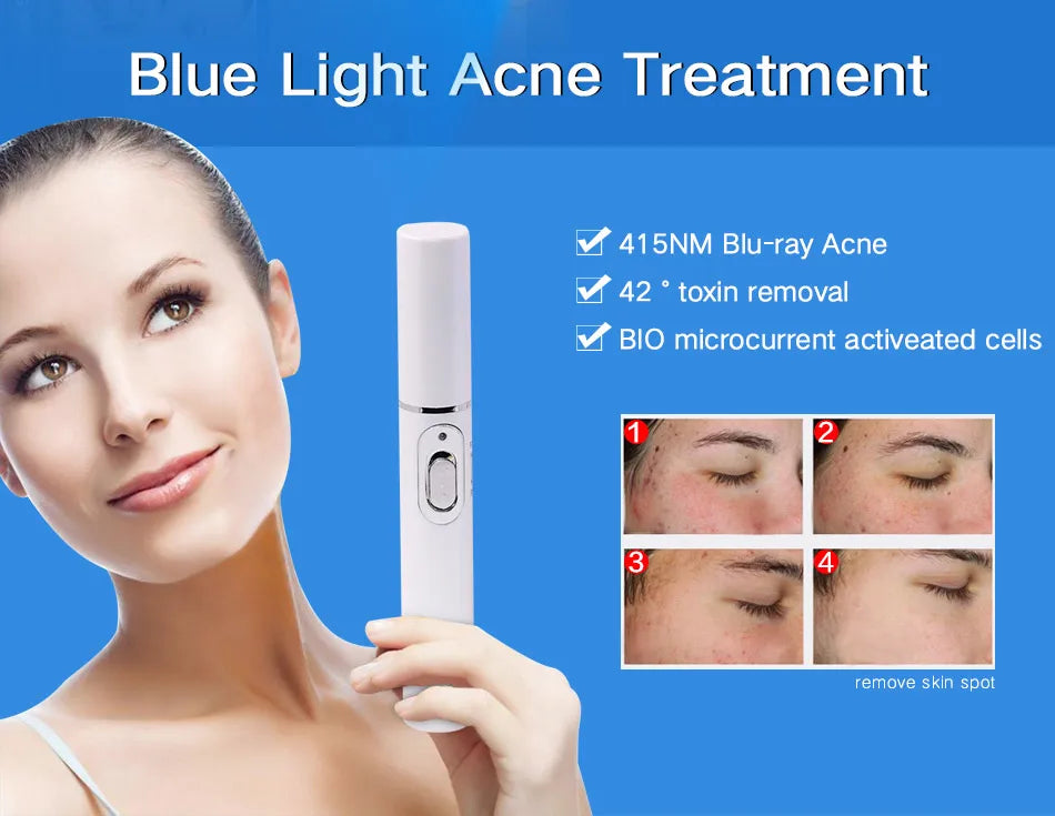 Blue Light Therapy Acne Pen for Skin Repair and Wrinkle Removal Permanent Makeup Machines Tidesmit