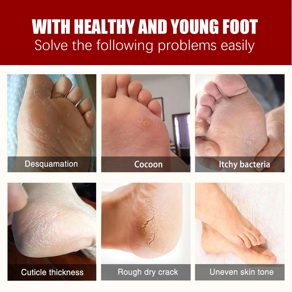 Exfoliating Foot Peel Mask - Apple Extract Callus Remover (5-15 Pack) Scrubs Treatments Tidesmit