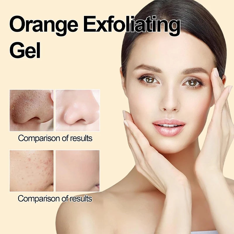 Facial Exfoliating Gel | Deep Pore Cleansing & Oil Control 200ml Scrubs Treatments Tidesmit