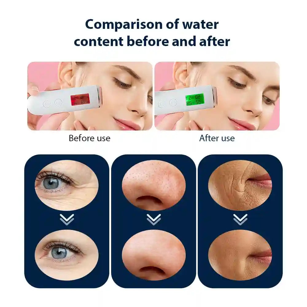 Oxygen Bubble Facial Machine for Deep Skin Cleansing | Tidesmit Eye Massage Instrument Tidesmit