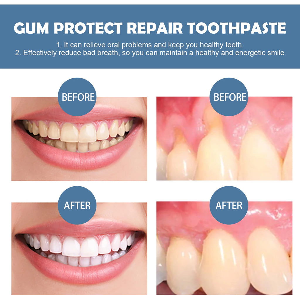 Tidesmit Rapid Repairing Gum Atrophy Toothpaste for dental sensitivity, cavity repair, and teeth whitening care.