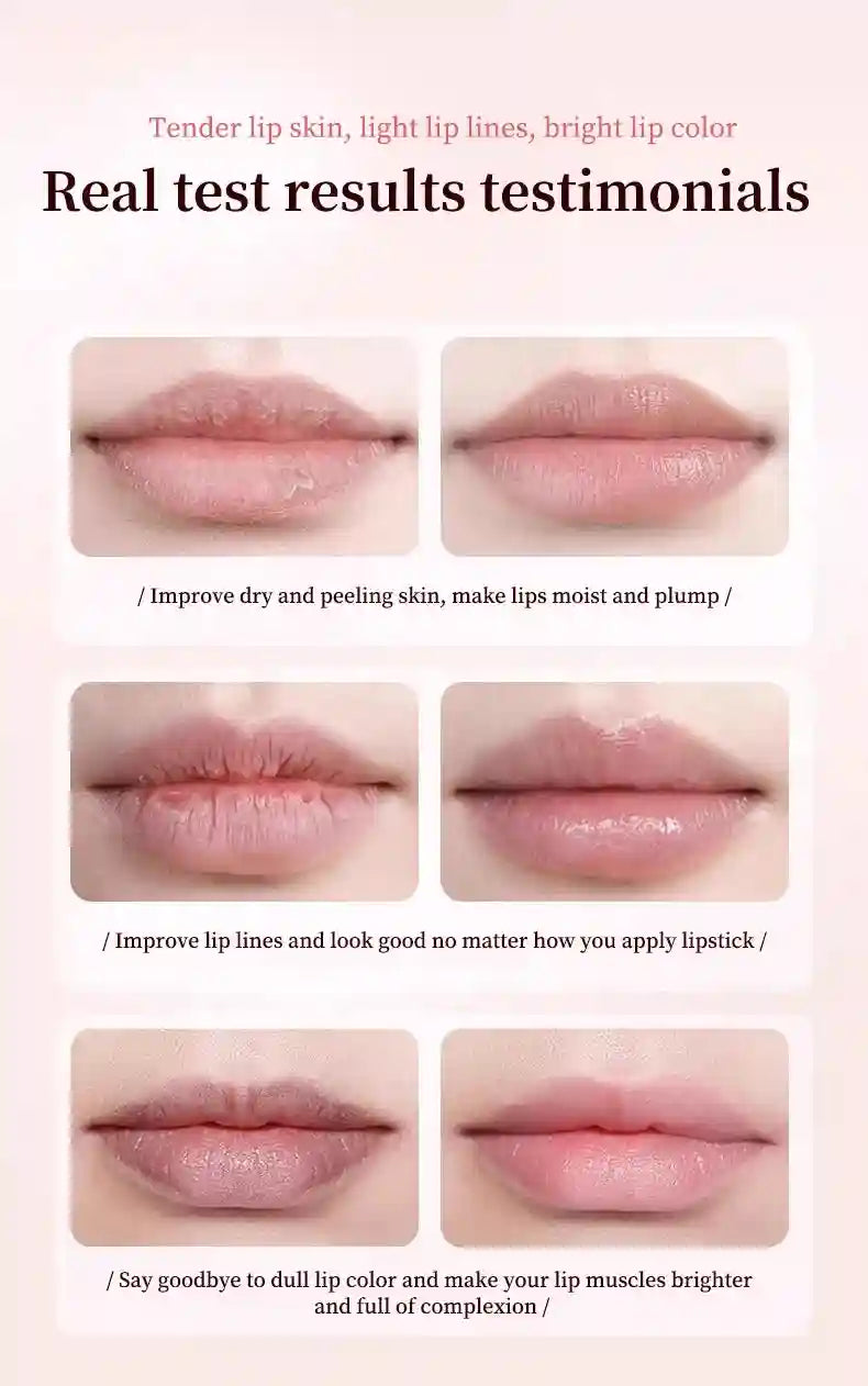 Lip Treatment for Dark Pigmentation - Moisturizing Exfoliator (1-5 Pcs) Lip Care Tidesmit