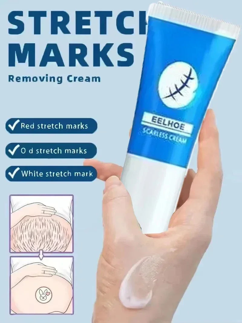 Stretch Mark Repair Cream for Pregnancy Postpartum Skin Recovery Relaxation Treatment Tidesmit