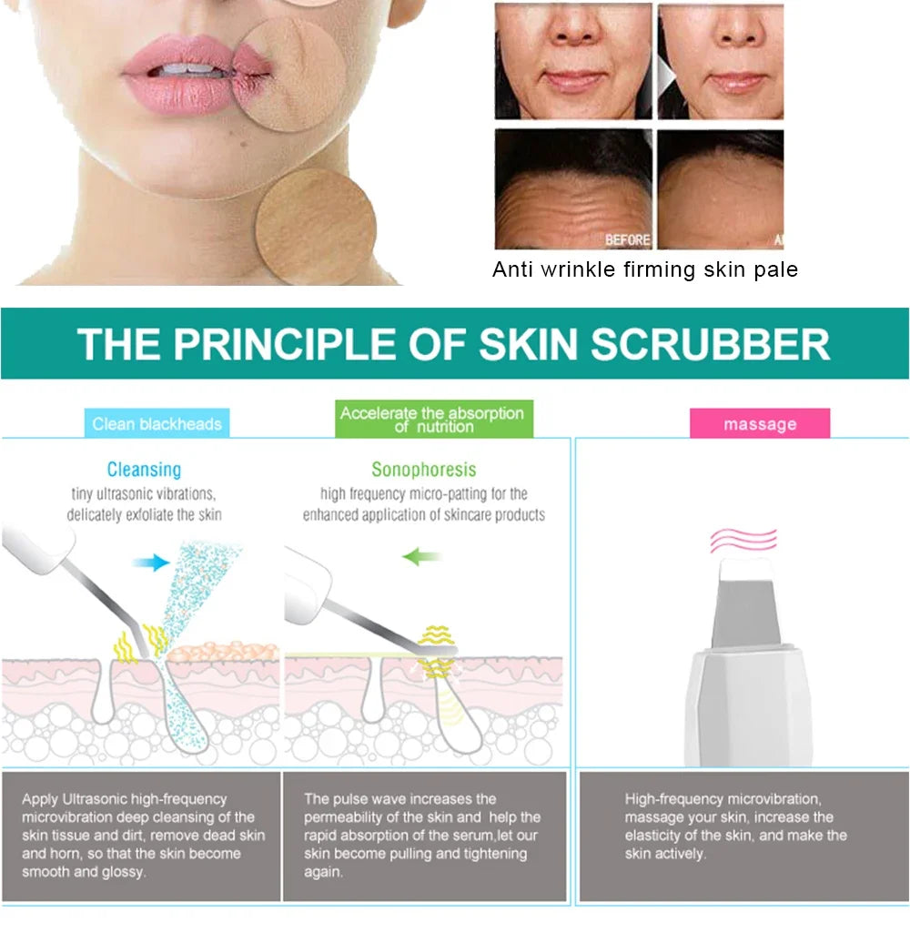 Ultrasonic Skin Scrubber | Deep Pore Cleanser & Acne Removal Tool Scrubs Treatments Tidesmit