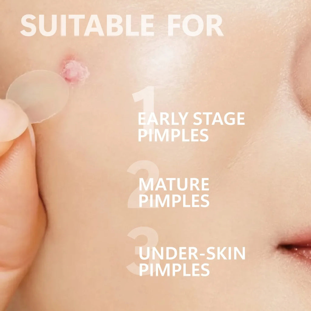 Microneedle acne patch, used to cover blemishes and conceal acne. The microneedles are shorter than 3 millimeters.