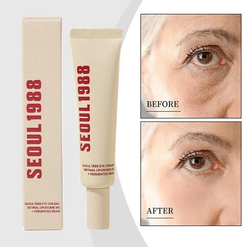Tidesmit Seoul 1988 4% Retinol Eye Cream for dark circles and wrinkles firming treatment texture close-up