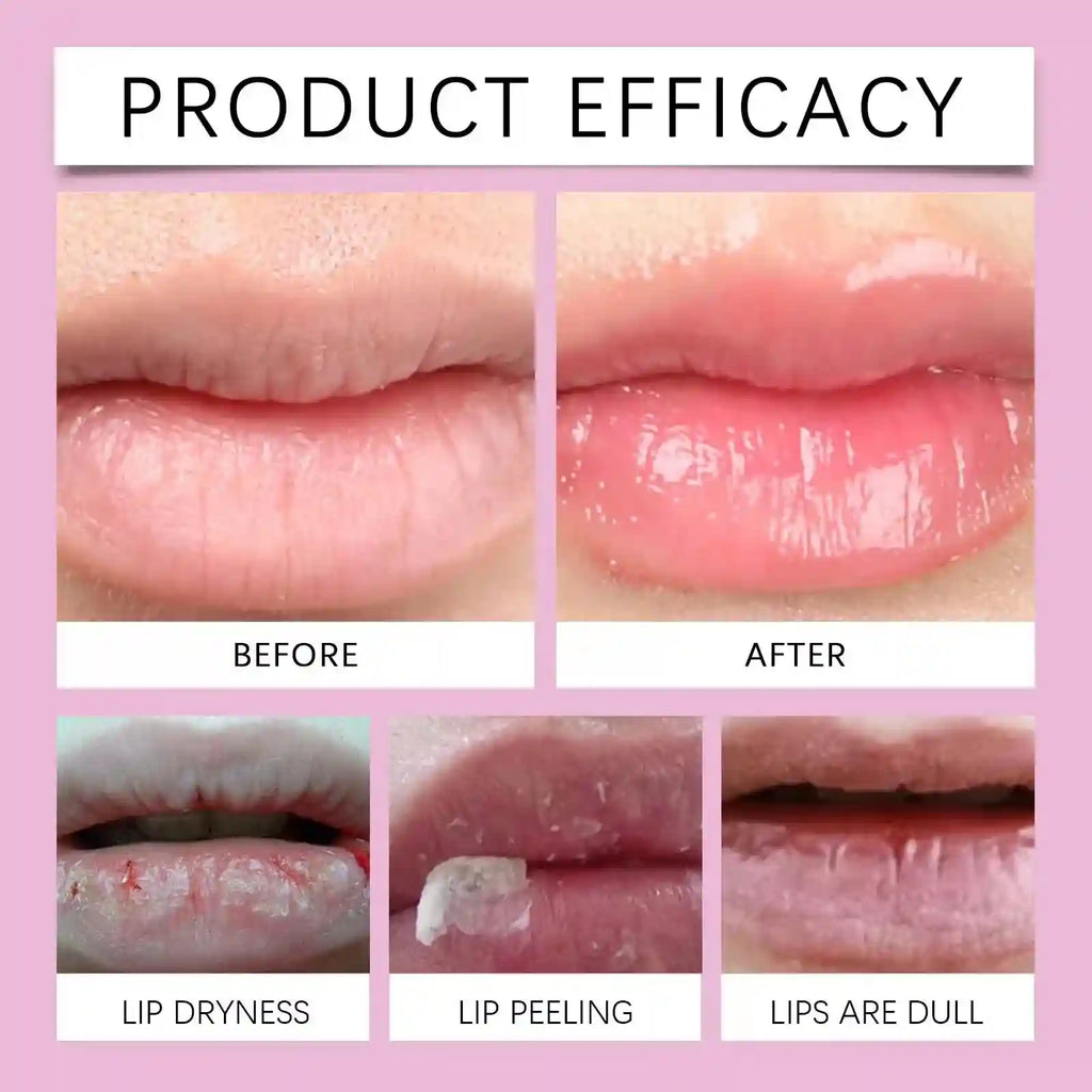 Instant Lip Plumping Serum | Moisturizing Anti-Wrinkle Treatment Lip Care Tidesmit