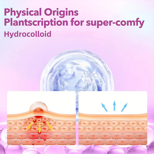 Hydrocolloid acne patch concept with skin cross-section and ingredient icons