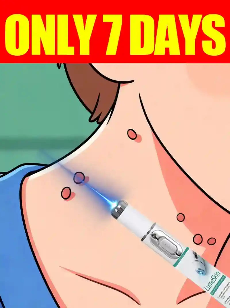 Blue Light Skin Tag & Wart Removal Pen | Precision Wellness Tool Back Massage Instrument Tidesmit