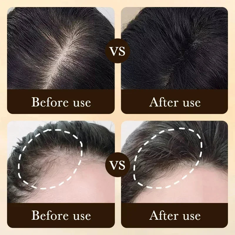 Biotin Hair Growth Oil for Thicker Hair | Natural Scalp Treatment Scrubs Treatments Tidesmit