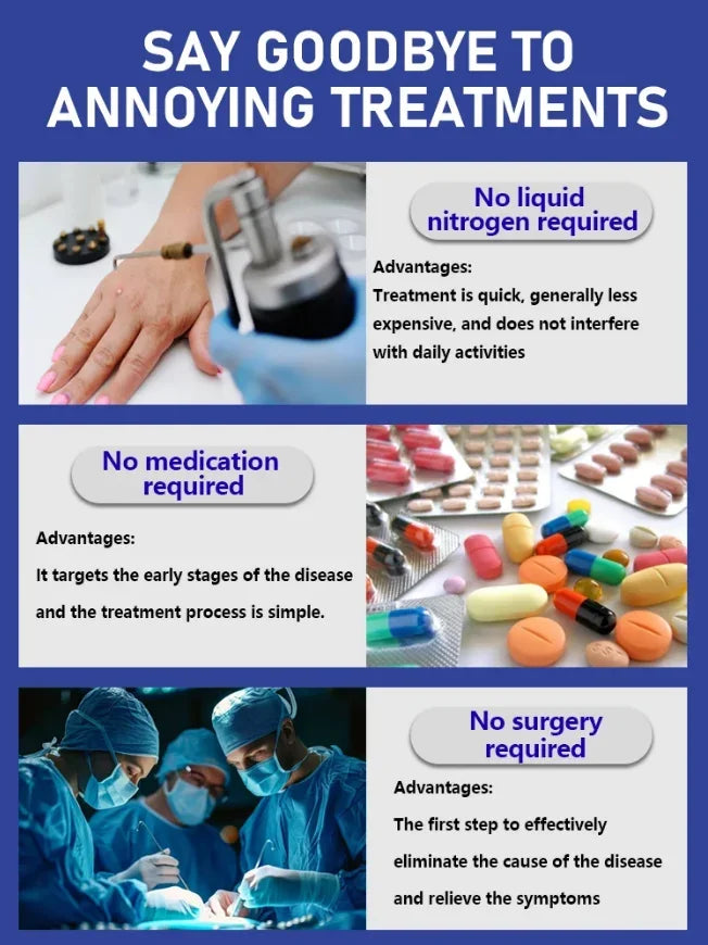 Home wart removal device infographic showing advantages over liquid nitrogen, medication, and surgery for skin health.