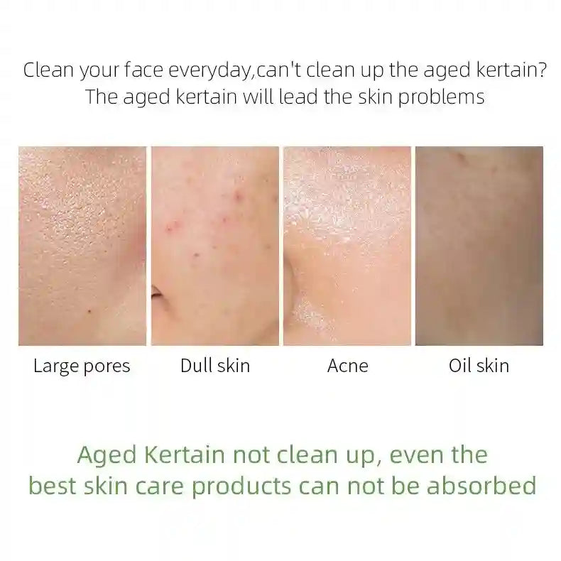 Matcha Facial Exfoliating Gel - Deep Pore Cleansing Scrub 60g Scrubs Treatments Tidesmit