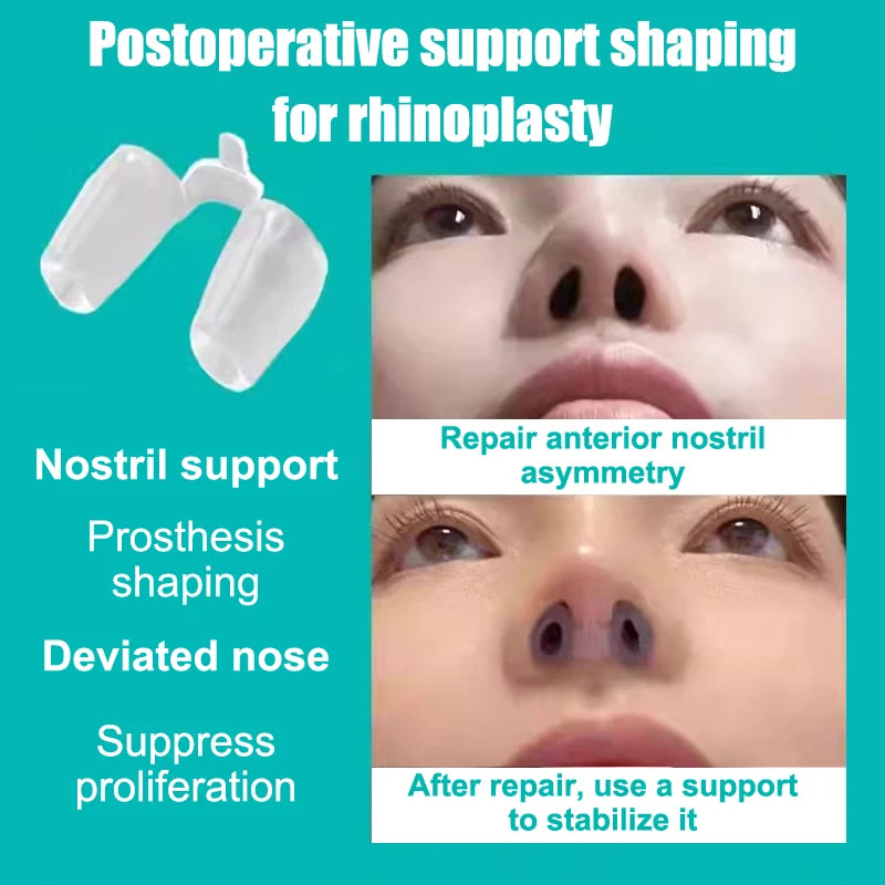 Clear silicone rhinoplasty nose clip for postoperative nostril support, shaping, and correcting deviated nose symmetry.