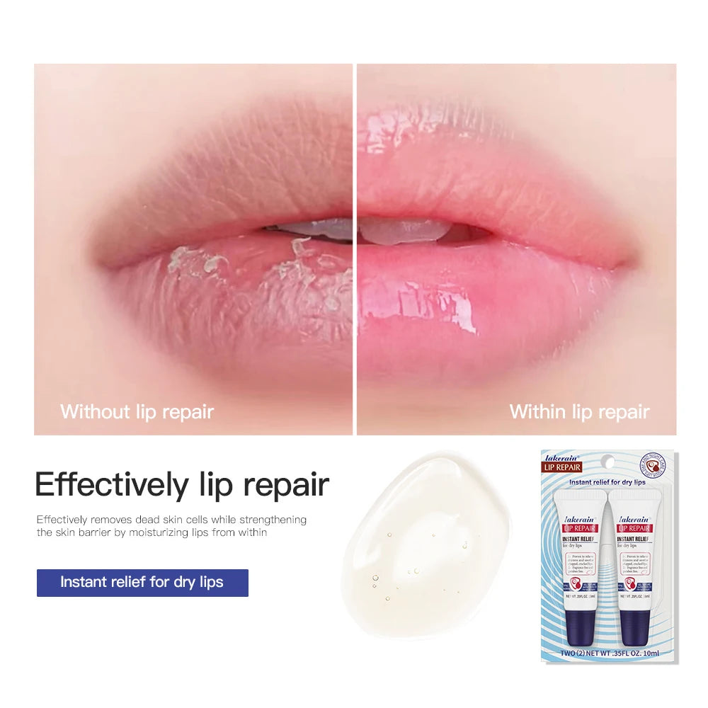 Lip Repair Gel: Instant Moisturizing Balm for Dry Lips - 2 Pack Lip Care Tidesmit