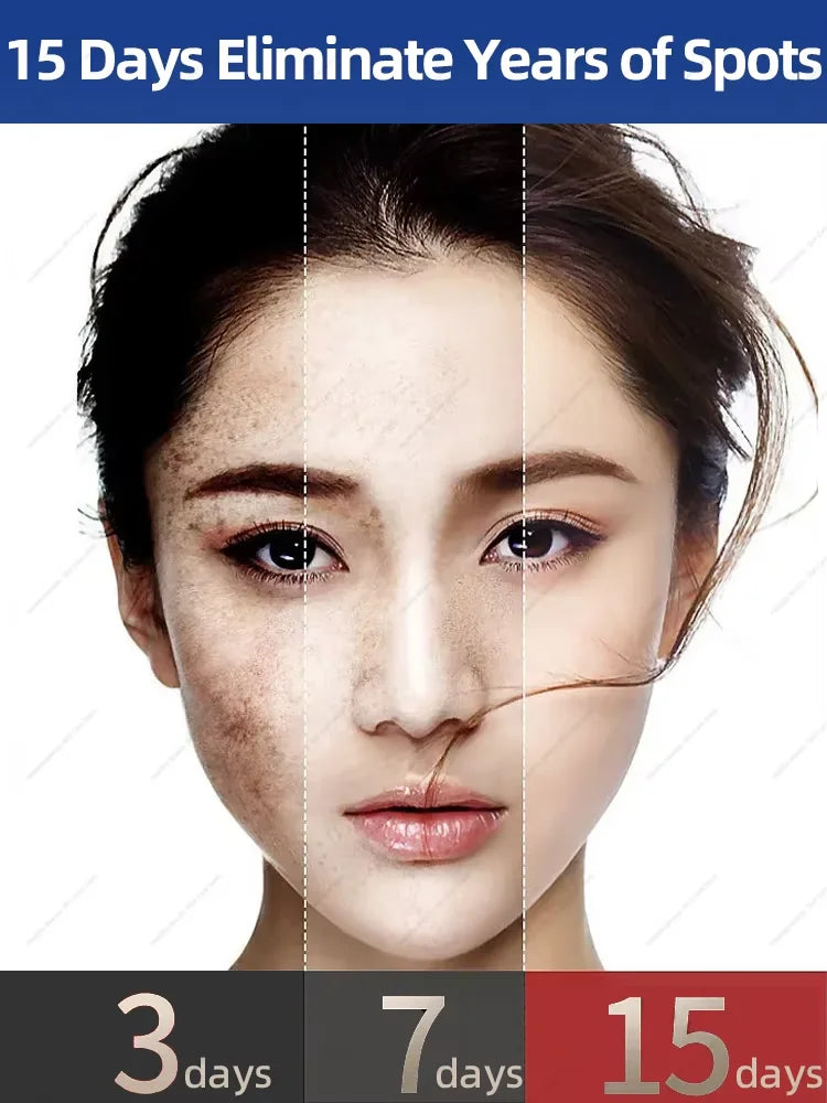 A before-and-after comparison of a woman's face showing skin spot reduction over 15 days.
