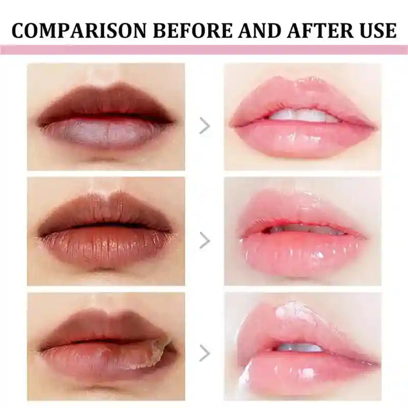 Lip Lightening Balm - Exfoliating Moisturizer for Dark Lips | Tidesmit Lip Care Tidesmit