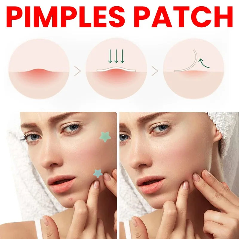 400pcs Star Acne Patches Invisible Pimple Cover for Face Oil Control Spot Treatment Cute Sticker for Covering Zits and Blemishes