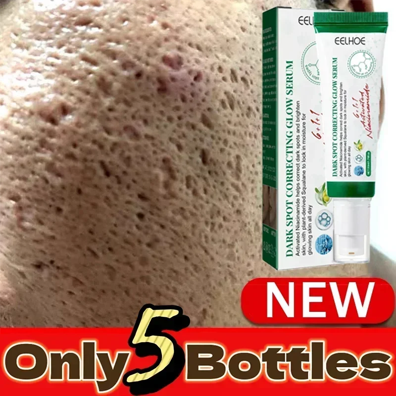 Acne Scar Cream for Face & Pore Fading Treatment | Tidesmit Scrubs Treatments Tidesmit