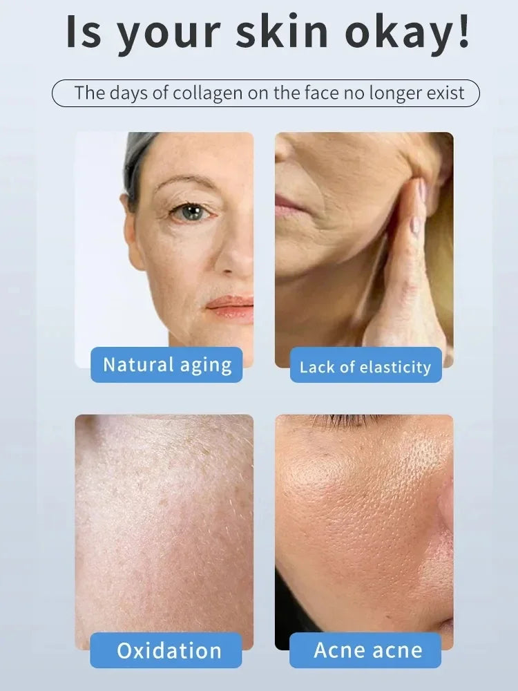 Collage showing aging, sagging, and acne skin concerns for professional LDM collagen face lifting beauty machine.