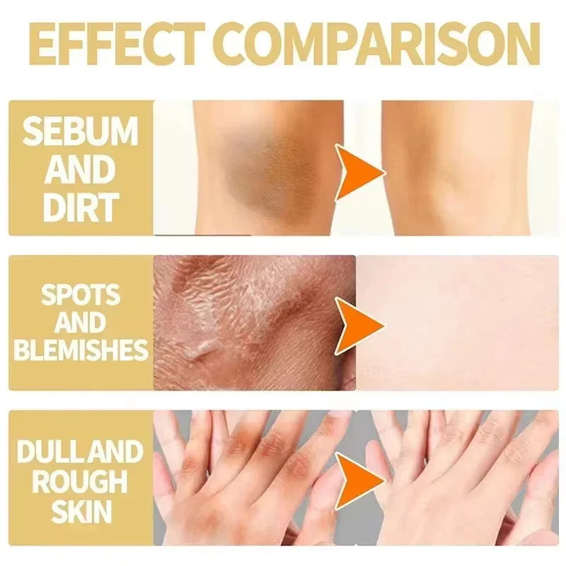 Yellow Peeling Oil for Body Exfoliation - Professional Brightening Serum Scrubs Treatments Tidesmit