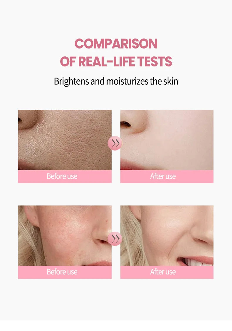 Pink Niacinamide Capsule Cream Moisturizing, Brightening, Delicate and Moisturizing Facial lotion Cream