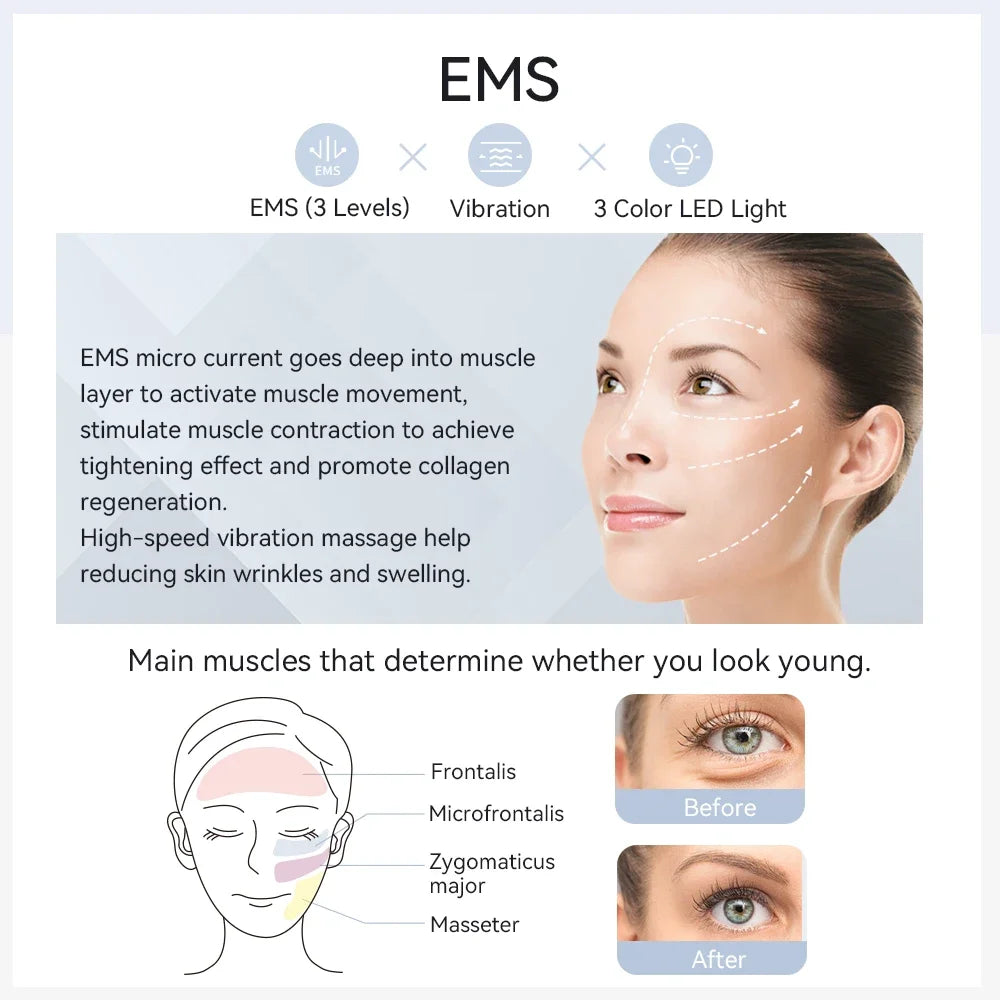ANLAN EMS facial massager with LED light and vibration for skin tightening, anti-aging, and face lifting treatment.