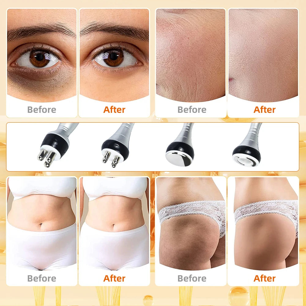 40k Ultrasonic Cavitation Machine for Targeted Body Shaping & Skin Tightening Body Shaping Massage Equipment Tidesmit