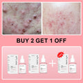 AFCARE collagen peptide facial serum set. Clear, pink-tinted dropper bottles with white boxes for skin repair.