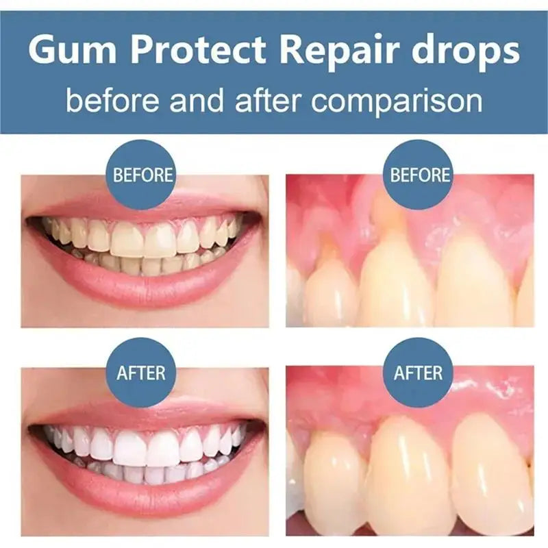 Tidesmit Gum Repair Care teeth whitening gel for reducing gingival inflammation and removing enamel stains
