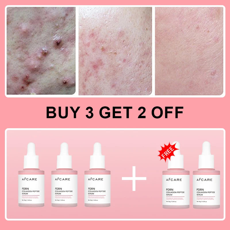 Collagen peptide facial serum bottles with pink liquid texture to repair skin and boost elasticity. 5-bottle promo set.