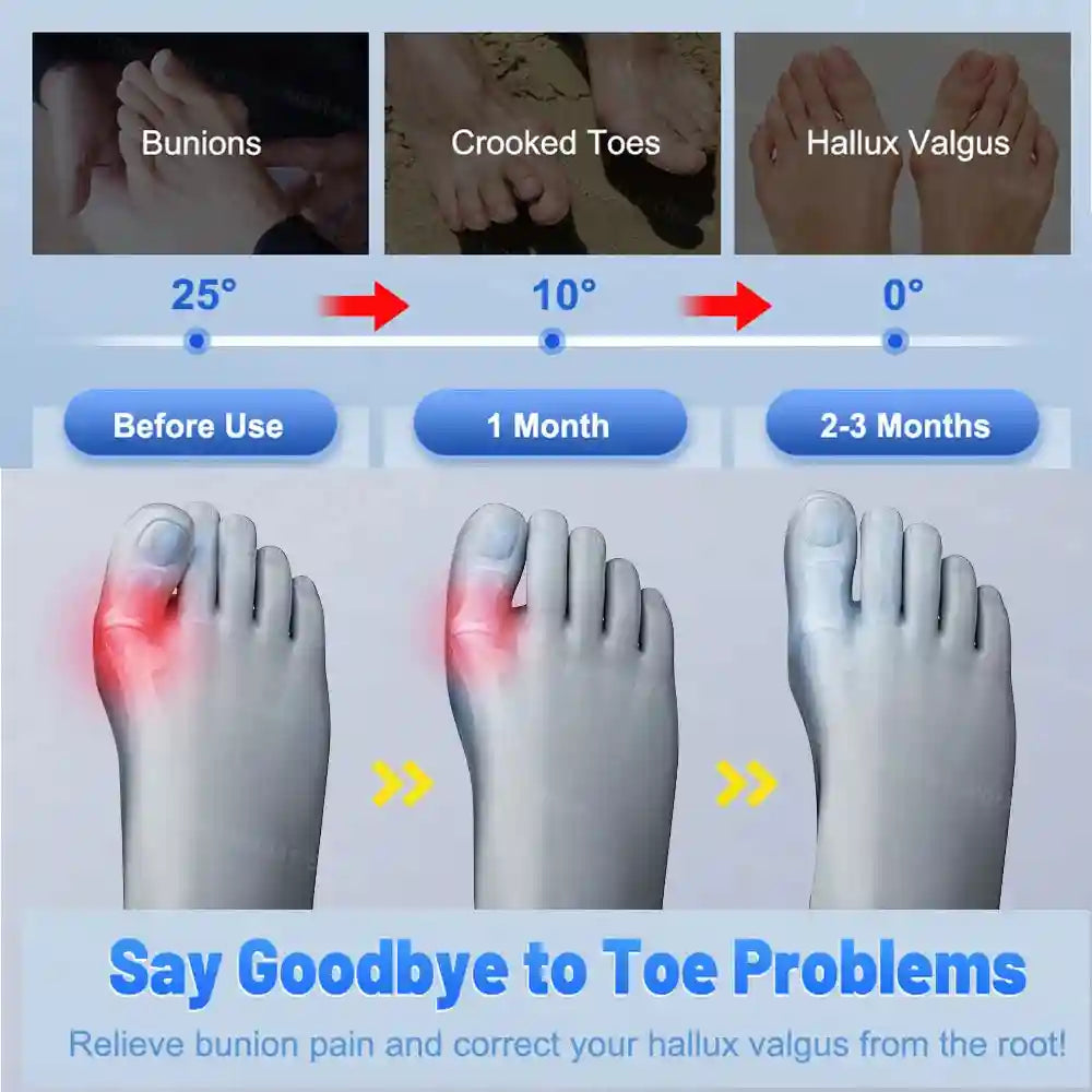 Bunion Corrector Toe Separator - Ergonomic Silicone for Hallux Valgus Massage Roller Tidesmit