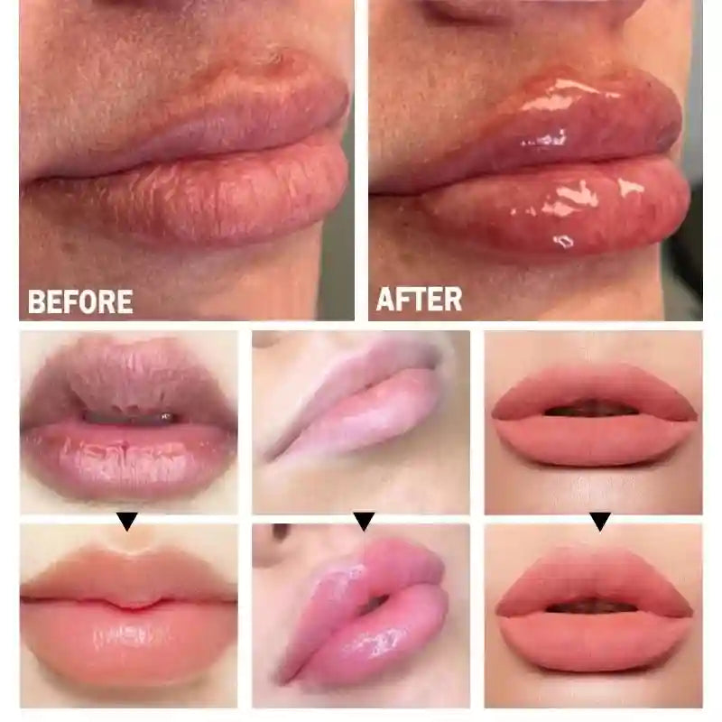 Volumizing Lip Serum: Hydrating Plumper for Fuller, Nourished Lips Lip Care Tidesmit