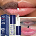 Pink Lip Lightening Serum for Dark Lips - Moisturizing Lip Care Lip Care Default Title Tidesmit