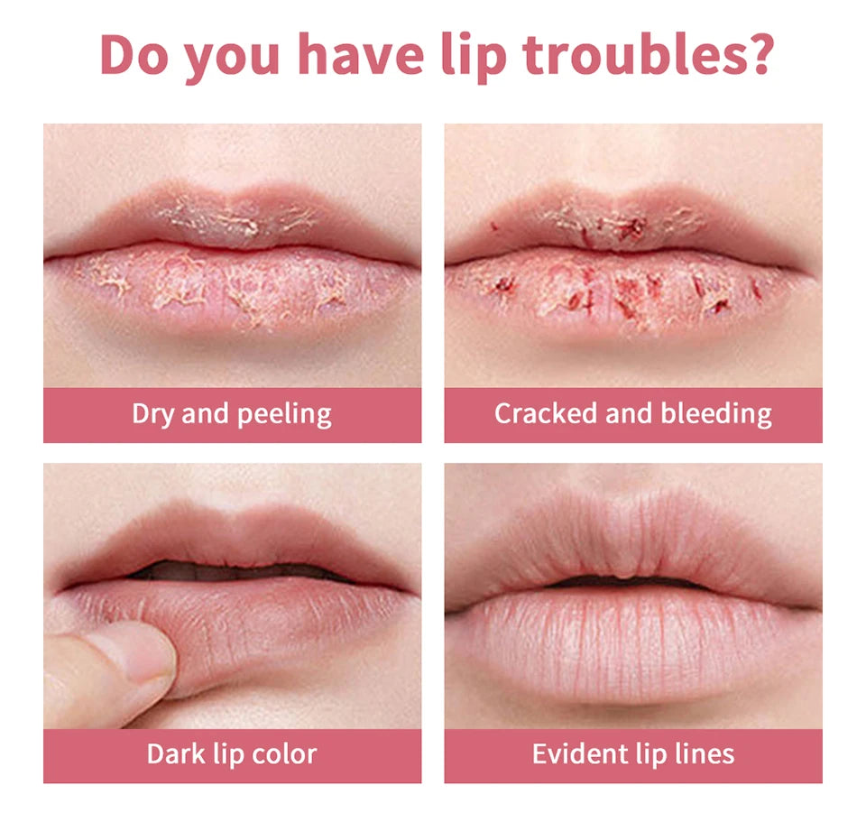 Collage showing dry, cracked, peeling, and lined lips to demonstrate the need for a nourishing moisturizing lip balm.