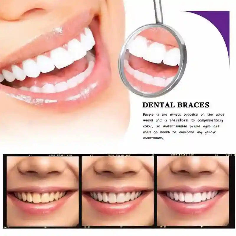 Tidesmit Smilekit purple teeth whitening mousse for tartar removal and fresh breath oral hygiene