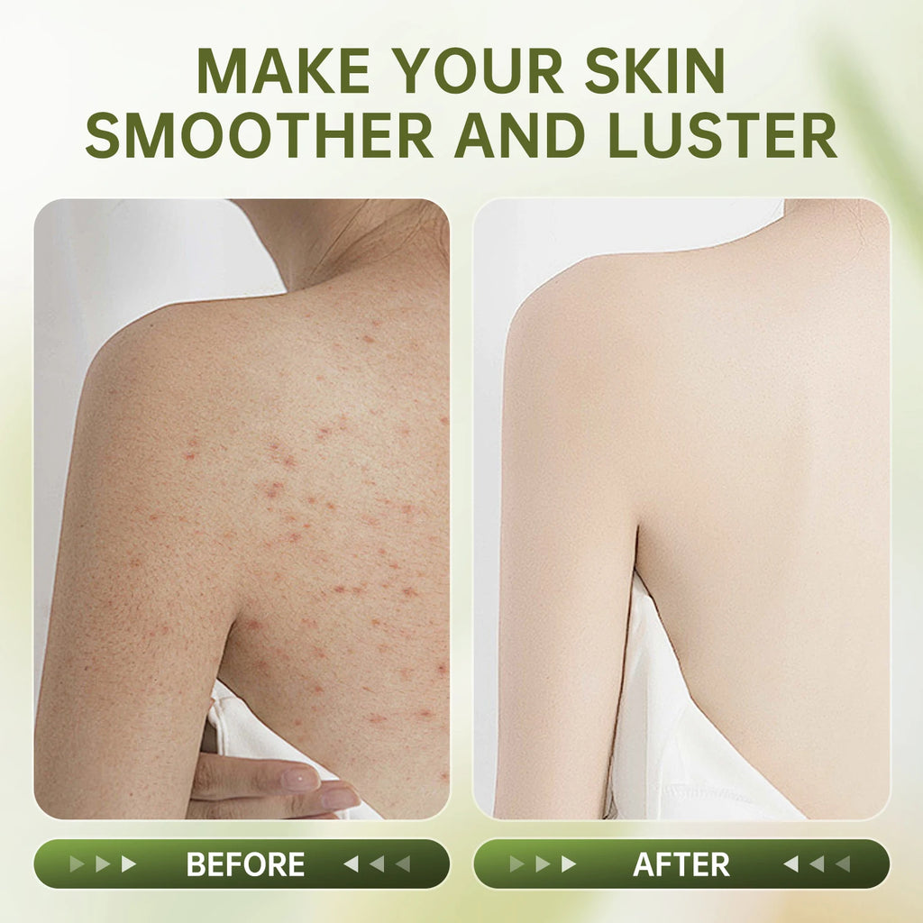 Avocado Body Scrub 250g | Professional Exfoliating Treatment for Glowing Skin Scrubs Treatments Tidesmit