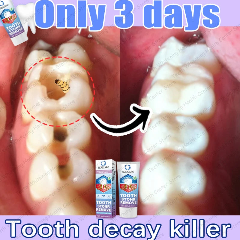 Tooth Decay Repair Treatment - Natural Oral Care Serum by Tidesmit Scrubs Treatments Tidesmit
