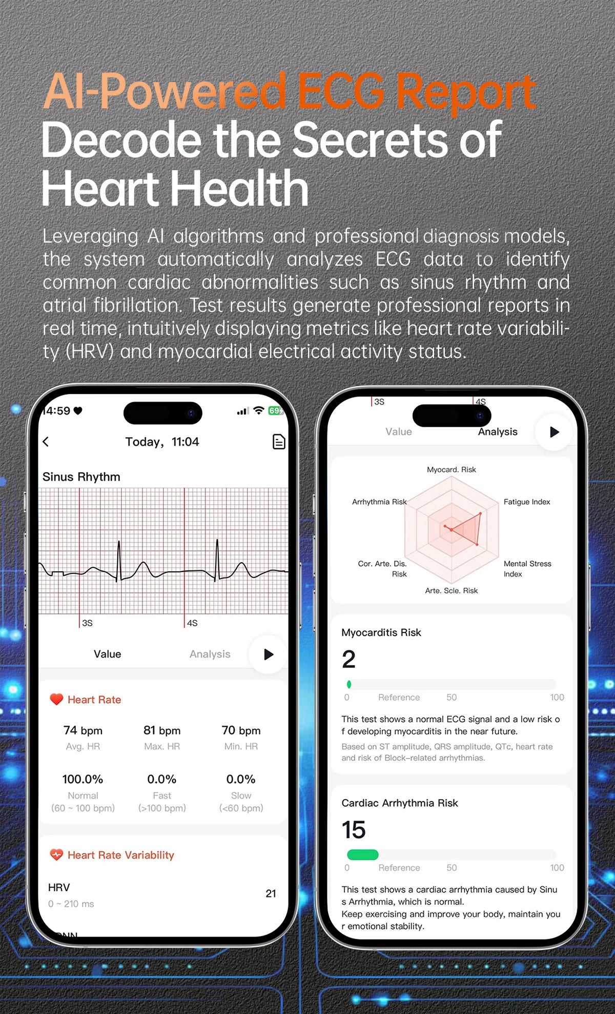 2026 New Smart Watch NFC ECG+PPG Blood oxygen Uric Acid Blood Pressure Sapphire Smartwatch Men For iPhone Android